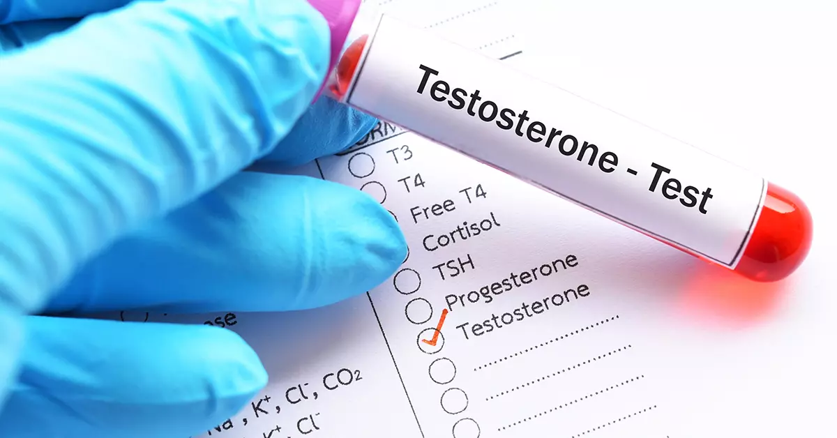 تستوسترون چیست و عملکرد آن کدام است؟
