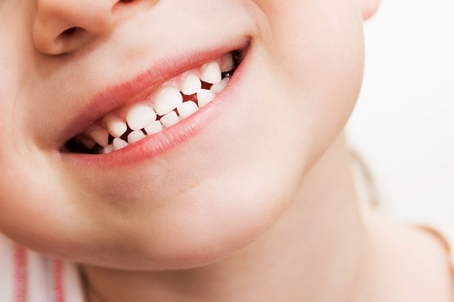 از بین بردن لکه های سیاه روی دندان کودک